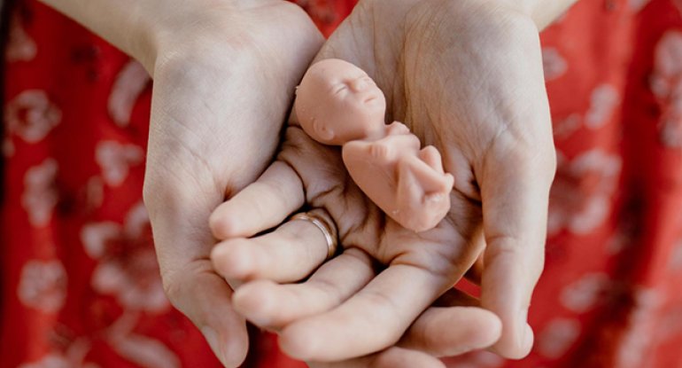 Azərbaycanda abortların sayı ilə bağlı vahiməli statistika